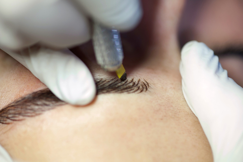 Microblading is a technique of drawing eyebrows.